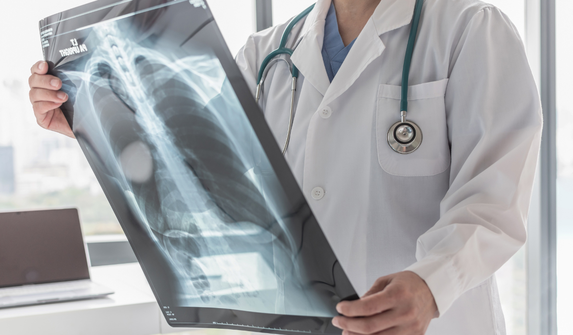 Blog Informativo Valadéz Radiólogos Guanajuato